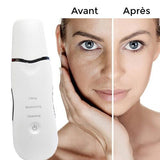 Rechargeable par ultrasons pour l'élimination des points noirs et l'exfoliation