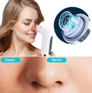 Nettoyant pour le visage et dissolvant de points noirs